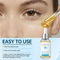 thumbnail image 3 of Stye Eye Treatment Serum Natural Remover with Styes Chalazion and Blepharitis, 1.01 Fl, 3 of 6