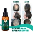 thumbnail image 2 of Suero para el Crecimiento del Cabello ANGGREK 30ML, 2 of 6