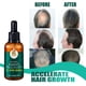 thumbnail image 4 of Suero Para El Crecimiento Del Cabello De 30ML, Aceite Para El Tratamiento Del Crecimiento Del Cabello, Aceite Para El Tratamiento Del Crecimiento Del Cabello Del Cuero Cabelludo ANGGREK Otros, 4 of 6