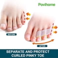 thumbnail image 3 of Povihome 10 Pack Pinky Toe Separator and Protectors for Overlapping Toe, Curled Pinky Toes - Spacers for Morton's Neuroma Pain Relief, 3 of 10