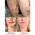 thumbnail image 4 of Crema Facial blanqueadora antipecas, Corrector de manchas oscuras, cosmético facial coreano para mujeres, cuidado de la piel blanqueador natural kaili Sencillez, 4 of 5