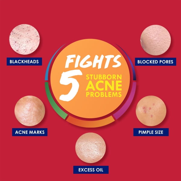 Acne Treatment Facial Cleansing Pads- Clearasil Stubborn Acne Control 5-in-1 Daily Pads with Salicylic Acid Acne Medication, 90 Count (3 Pack)