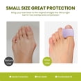 thumbnail image 5 of Bukihome Toe Separator for Overlapping Toes - 12 Pack Toe Spacers for Bunions with Lavender Extract - Toe Corrector for Hammer Toes, Realign Crooked Toes (Multi-Size, Lavender), 5 of 8