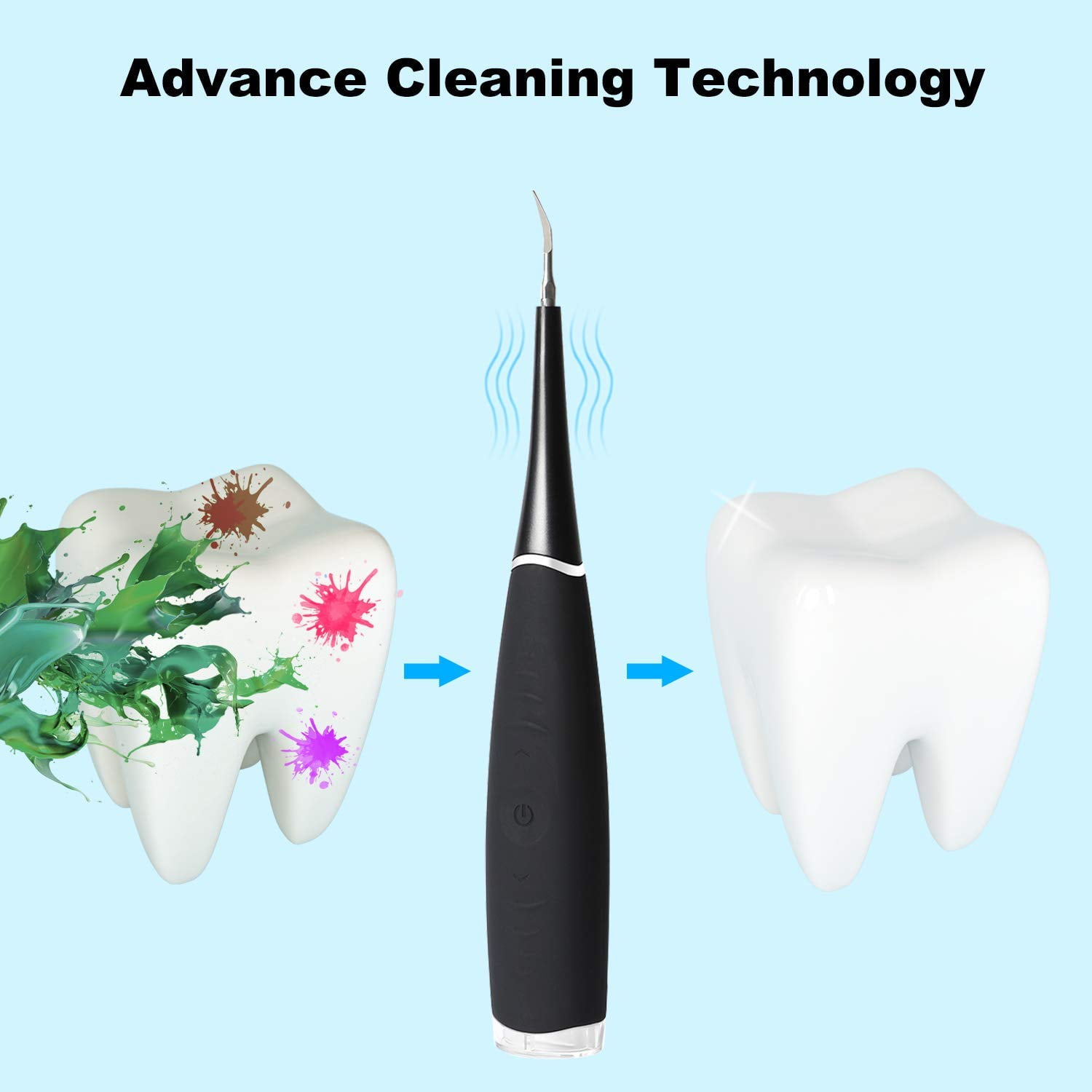 Buy Electric Dental Calculus Remover, HighFrequency Vibration Plaque Remover Tartar Remover for