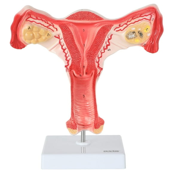 Axis Scientific Female Reproductive Anatomy Model - Polycystic Ovary Educational Demonstration