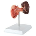 thumbnail image 4 of Axis Scientific Spleen, Pancreas and Duodenum Anatomy Model - Detailed Lymphatic System Anatomy Model for Gastroenterologists, Lympologists, Medical Students - Durable and Realistic, 4 of 6