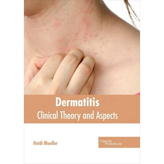 Dermatitis: Clinical Theory and Aspects, (Hardcover)