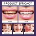 thumbnail image 3 of Xylitol Toothpaste for Adults Whitening Teeth Whitening Toothpaste,White Teeth, Toothpaste For Pain Sensitive Teeth, Teeth Whitening Toothpaste for Adults 100G/3.53 OZ, 3 of 7