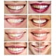 thumbnail image 4 of White Teeth Global 10 jeringas (3 ml) Nuevo gel blanqueador de dientes con peróxido de carbamida al 44% más fuerte, 4 of 5