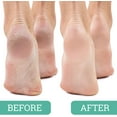 thumbnail image 3 of Maccibelle Salon Foot Pumice and Scrubber for Feet and Heels Callus and Dead Skins, Safely and Easily Eliminate Callus and Rough Heels Pack of 4, 3 of 5