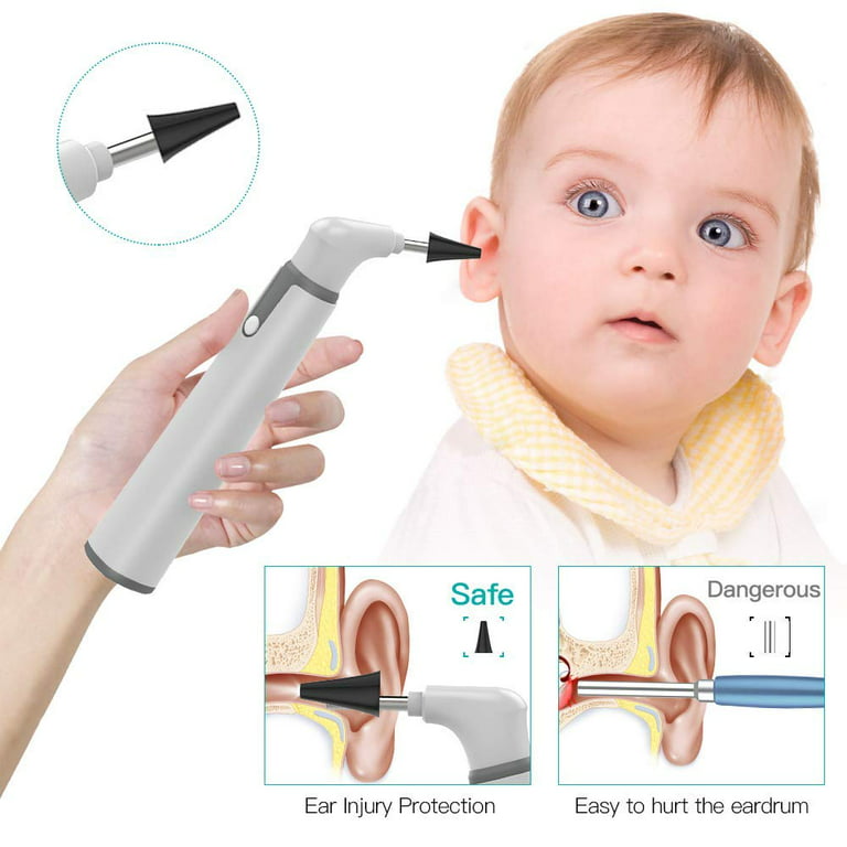  Ear Wax Removal - NIUQICT Ear Cleaner - Ear Camera 1080P with  Lights - Ear Wax Removal Tool 9 Pcs - Ear Cleaning Kit, Wireless Otoscope  Compatible with Android&iOS for Kids