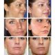 thumbnail image 2 of AUQUEST-crema facial con vitamina C para el cuidado de la piel, hidratante, reafirmante, antienvejecimiento, elimina manchas oscuras, blanqueamiento, belleza y salud"one" Fivean LED, 2 of 2