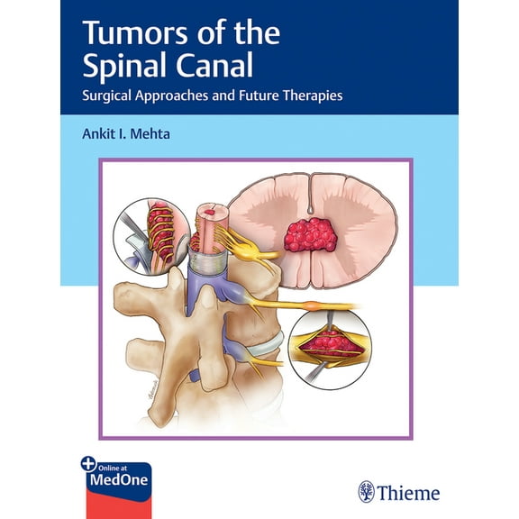 Tumors of the Spinal Canal: Surgical Approaches and Future Therapies (Hardcover)