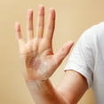 thumbnail image 3 of Carpal AID Quick Relief from Carpal Tunnel Syndrome, One Size, 3 of 5
