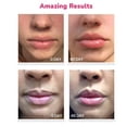 thumbnail image 4 of LifeCell Lip Plumping Treatment, 4 of 5