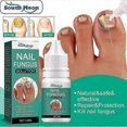 thumbnail image 3 of Nail Fungal Treatment Feet Care Essence Anti Infection Paronychia Onycho, 3 of 5