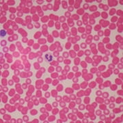 CAROLINA BIOLOGICAL SUPPLY COMPANY Human Male Blood Film Slide, Smear