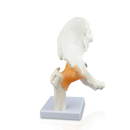 Vision Scientific Hip Joint Model