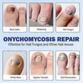 thumbnail image 5 of Fungal Nail Repair Patches, Waterproof Toenail Treatment & Correction Stickers for Damaged Nails_c*, 5 of 5