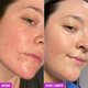 thumbnail image 5 of Barra limpiadora para rostro y cuerpo Good Molecules Clarify Cleanse 89 g, 5 of 7