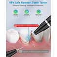 thumbnail image 2 of Ultrasonic Teeth Cleaner - Plaque Remover For Removing Teeth Stains, 2 of 5