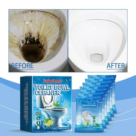 

Scientific Descaling Without Home Essentials Damaging The Enamel Stains Can Cleaning Supplies Be Easily Household Cleaning Christmas Clearance Removed With Just One Rinse Easy And Hygienic
