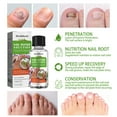 IIRich Toenail Fungus Treatment For Toenail Or Fingernail, Fast Acting
