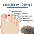 thumbnail image 3 of 3packs Nail Repair Patches, Nail Fungus Treatments, Split Nail Repair, Waterproof And Breathable Foot Care Nail Repair E, 3 of 5
