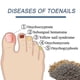 thumbnail image 3 of 3packs Nail Repair Patches, Nail Fungus Treatments, Split Nail Repair, Waterproof And Breathable Foot Care Nail Repair E, 3 of 5