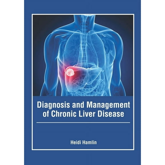 Diagnosis and Management of Chronic Liver Disease, (Hardcover)