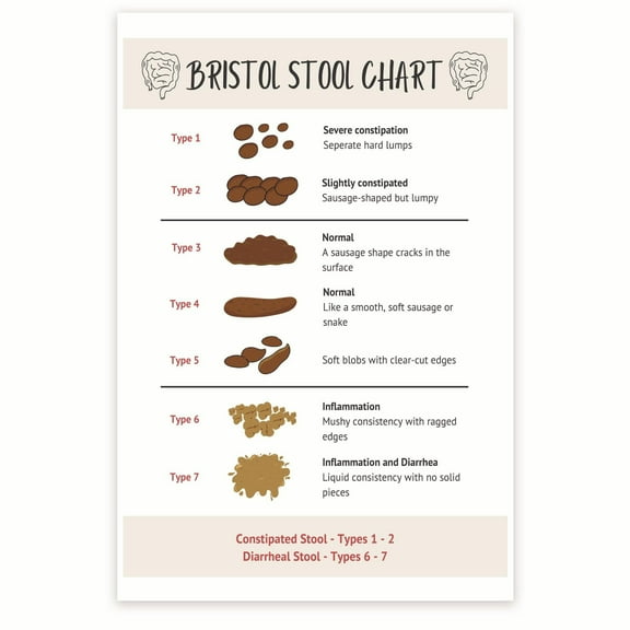 Bristol Stool Chart - Gastrointestinal Health Chart - Digestive System Poster - Poop Consistency
