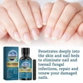 Moisturize Nail Repai Care Toenail Extra Strength For Toenail
