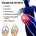 thumbnail image 4 of 20g Rheumatoid Arthritis Cream, Rheumatoid Arthritis Pain Relieving Cream Rheumatic Joint Cream, 4 of 5