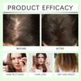 thumbnail image 3 of HOARBOEG Hair Fall Hair Shampoo Oil Control Dandruff Hair 300ml Clearance Sale, 3 of 7