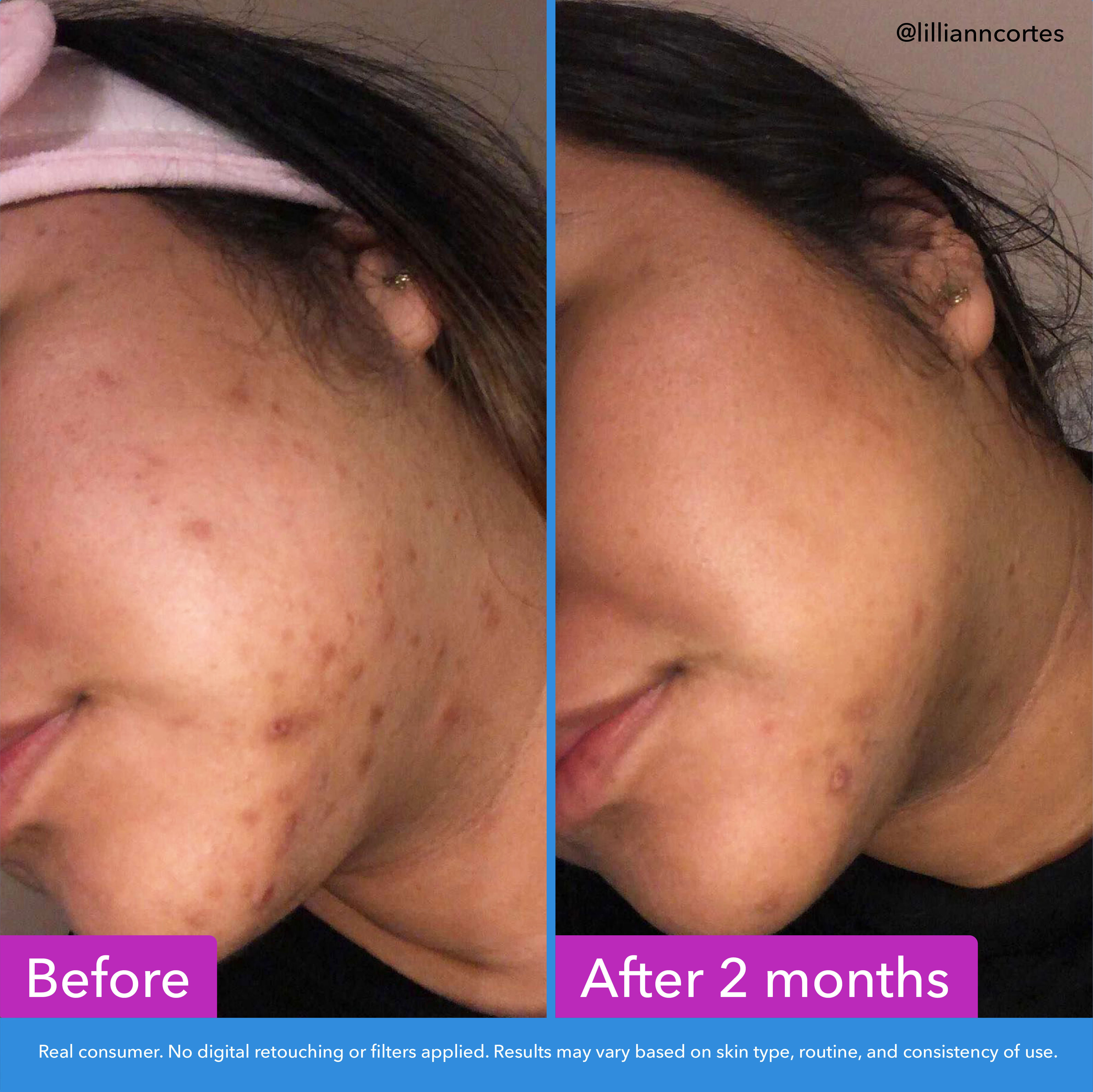 Good Molecules Discoloration Correcting Serum photo 3