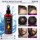 thumbnail image 3 of Previene la caída del cabello con aceite de ricino y extracto de biotina. Sérum capilar intensivo para hombres y mujeres, 60 ml., 3 of 8