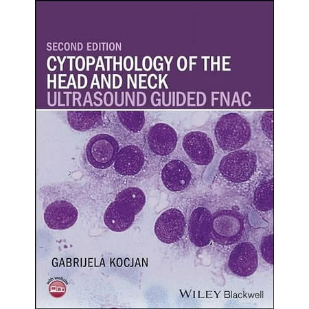 Pre-Owned: Cytopathology of the Head and Neck: Ultrasound Guided FNAC (Hardcover, 9781118076026, 1118076028)