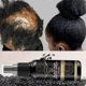 thumbnail image 1 of Black Rice Hair Growth Spray Repairs Damage Restore Soft Hair For All Hair Types Fast Treatment Prevent Hair Thinning Dry Repair, 1 of 5