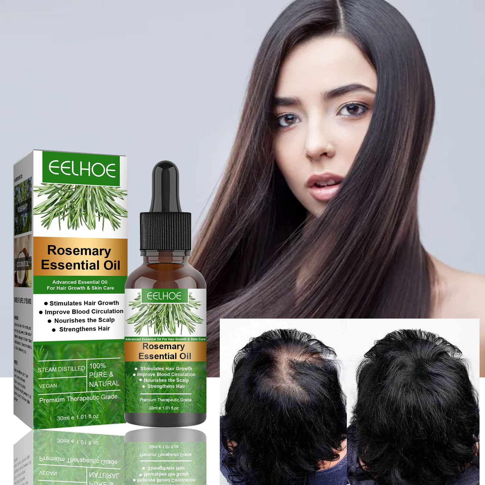 Rosemaryoil For Hair Growth Skin Care Nourishment Scalp Stimulates Improves Blood Circulation Rid Of Itchy And Dry Scalp 30ml Rosemaryoil For Hair Growth Skin Care Nourishment Scalp Stimulates Improves Blood Circulation Rid Of Itchy And Dry Scalp 30ml