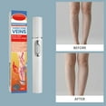 thumbnail image 3 of SharkTRUE Lightweight Skin Care Pen: Precise, Safe, Easy Operation for Blemish Removal, 3 of 8