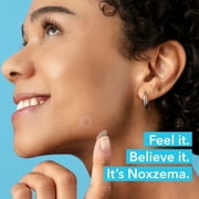 Noxzema Blemish Patches - Hydrocolloid Acne Pimple Patches with Niacinamide & Tea Tree Extract - 30 Count