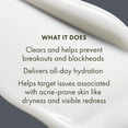 thumbnail image 3 of Crema hidratante Origins Clear Improvement Acne 50 ml con ácido salicílico y ácido hialurónico, 3 of 6