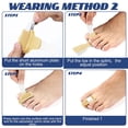 thumbnail image 2 of Scheam 4Pcs Toe Splint Toe Fixation Corrector Broken Toe Brace Toe Straightener for Hammer Toe, Curled Toe, Big Toe, Women Men Broken Toe Support Toe Wraps, Breathable Beige, 2 of 7