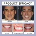 thumbnail image 5 of Soft Denture Reline Kit, Denture Repair Kit, Snap On Dentures Teeth Denture Top Bottom Denture Soft Relining, 5 of 5