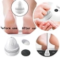 thumbnail image 2 of 2/1 Sets Foot Grinder,Wireless Portable Electric Foot Grinder, Electric Foot Callus Remover, 2 Speed Levels & 2 Grinding Heads, Skin Trimmer Dead Skin, 2 of 9