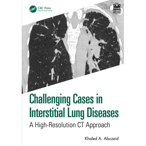 Challenging Cases Challenging Cases in Interstitial Lung Diseases: A High-Resolution CT Approach, (Paperback)