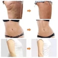 thumbnail image 5 of Liposuction Machine VE Sport Body Belly Arm Leg Fat Burning Body Shaping Slimming Massage Smart Fitness EMS Weight Loss Pads, 5 of 5
