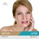 thumbnail image 5 of Sérum facial iluminador Sun Coast Sciences Derma Bright MD, 5 of 6