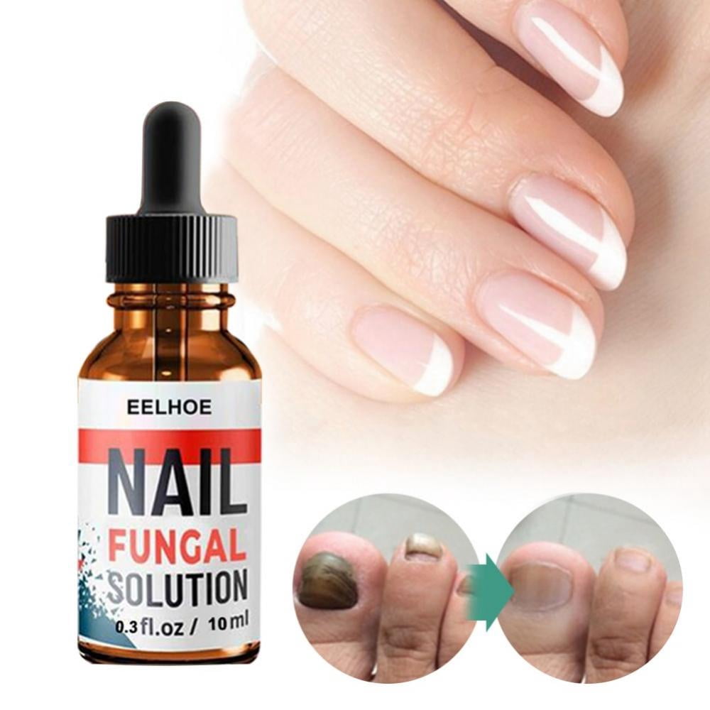 Extra Strong Nail & Toe Fungus Treatment, Best Nail Repair Set, Fungi