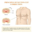 thumbnail image 4 of Pectus Excavatum Vacuum Bell - Pectus Excavatum Orthosis Brace,Physical Correction,Washable,Real-Time Pressure Monitoring,Easy to Operate, 4 of 8